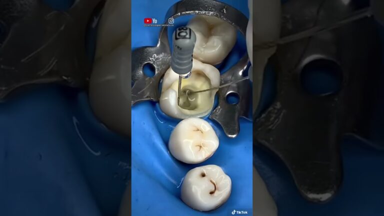 dental del parque de atenas