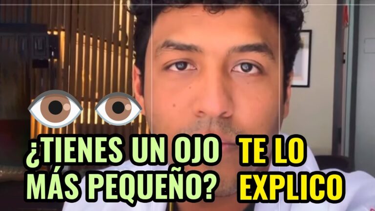 famosas con un ojo mas grande que el otro